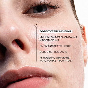 Allies of Skin Azelaic & Kojic Advanced Clarifying Serum Сыворотка с азелаиновой и койевой кислотами (30 мл.) Allies of Skin Azelaic & Kojic Advanced Clarifying Serum Сыворотка с азелаиновой и койевой кислотами (30 мл.)