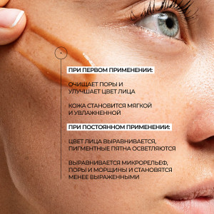 Allies of Skin Mandelic Pigmentation Corrector Night Serum Обновляющая ночная сыворотка с миндальной кислотой против пигментации (30 мл.) Allies of Skin Mandelic Pigmentation Corrector Night Serum Обновляющая ночная сыворотка с миндальной кислотой против пигментации (30 мл.)
